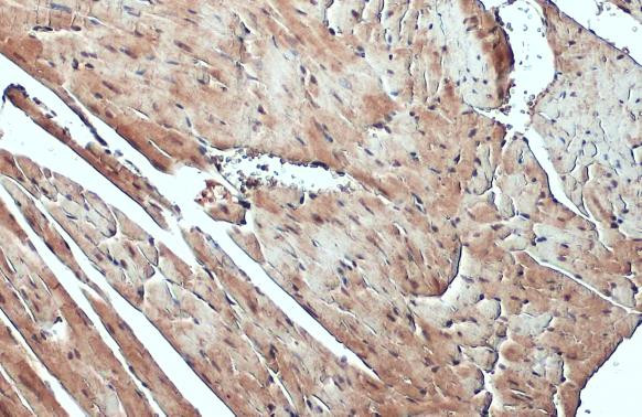 FBXL17 Antibody in Immunohistochemistry (Paraffin) (IHC (P))