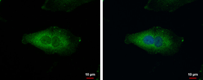 NDUFAF5 Antibody in Immunocytochemistry (ICC/IF)