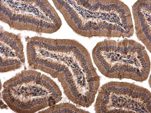 SPRY4 Antibody in Immunohistochemistry (Paraffin) (IHC (P))
