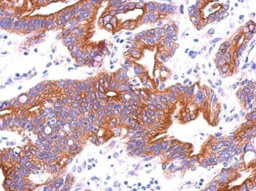 ITFG3 Antibody in Immunohistochemistry (Paraffin) (IHC (P))