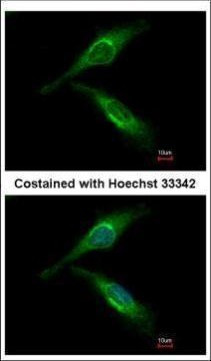 ARFGAP2 Antibody in Immunocytochemistry (ICC/IF)