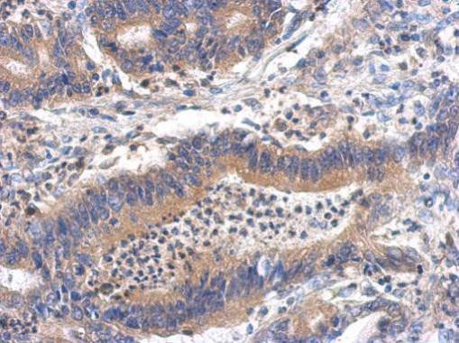 GHDC Antibody in Immunohistochemistry (Paraffin) (IHC (P))