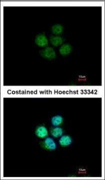 ZNF587 Antibody in Immunocytochemistry (ICC/IF)