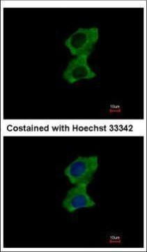 ZNF598 Antibody in Immunocytochemistry (ICC/IF)