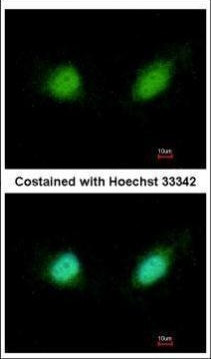 GABPB2 Antibody in Immunocytochemistry (ICC/IF)