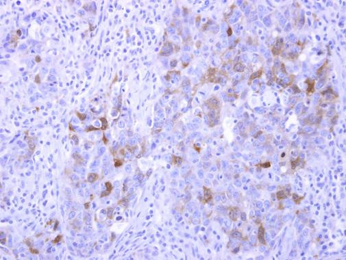PHOSPHO1 Antibody in Immunohistochemistry (Paraffin) (IHC (P))