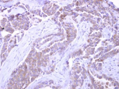 SNX33 Antibody in Immunohistochemistry (Paraffin) (IHC (P))
