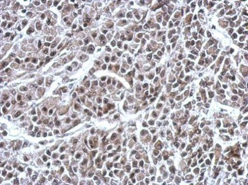 RNF180 Antibody in Immunohistochemistry (Paraffin) (IHC (P))
