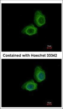 UBE2O Antibody in Immunocytochemistry (ICC/IF)
