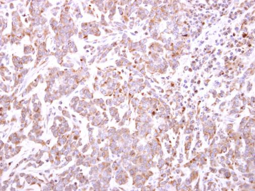 TRIM49 Antibody in Immunohistochemistry (Paraffin) (IHC (P))