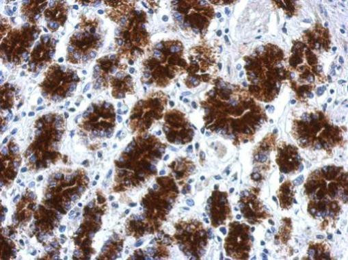 CPXCR1 Antibody in Immunohistochemistry (Paraffin) (IHC (P))