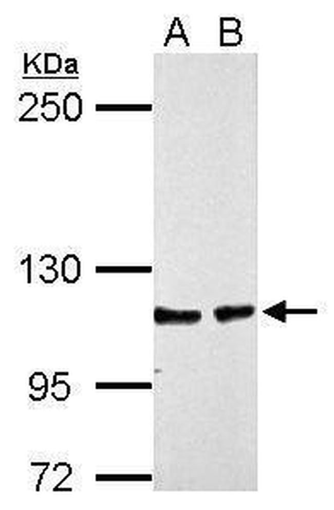 CHD1L Antibody in Western Blot (WB)