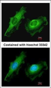 ITM2B Antibody in Immunocytochemistry (ICC/IF)