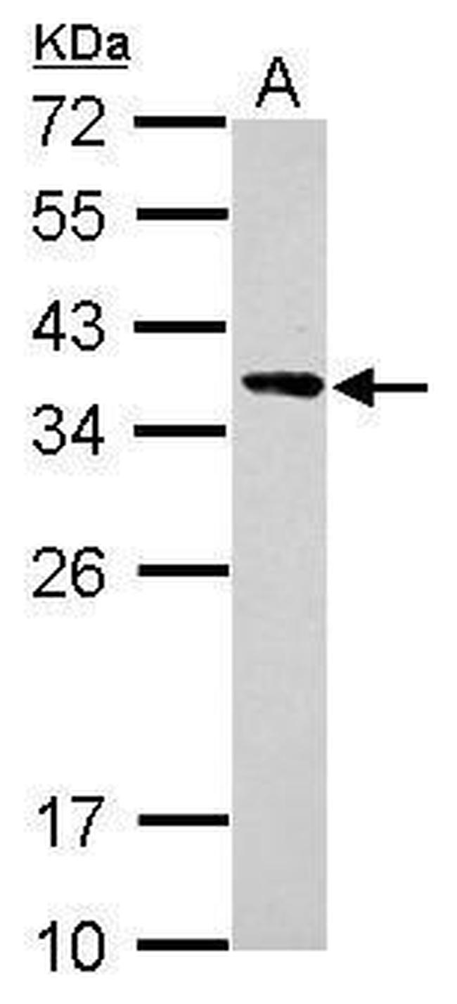 Calponin 2 Antibody in Western Blot (WB)