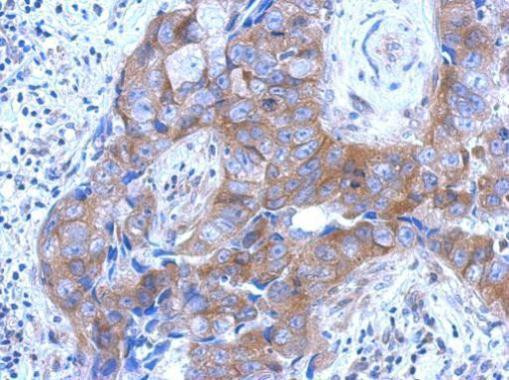 Brevican Antibody in Immunohistochemistry (Paraffin) (IHC (P))