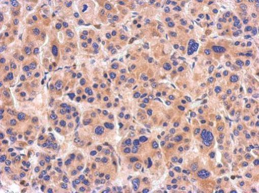 NTAN1 Antibody in Immunohistochemistry (Paraffin) (IHC (P))