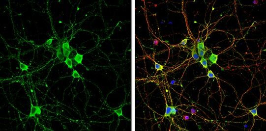 PPFIA2 Antibody in Immunocytochemistry (ICC/IF)