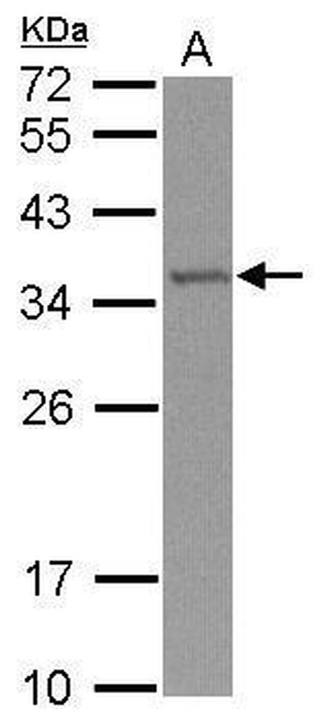 TRMT61A Antibody in Western Blot (WB)