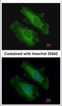 SNX18 Antibody in Immunocytochemistry (ICC/IF)