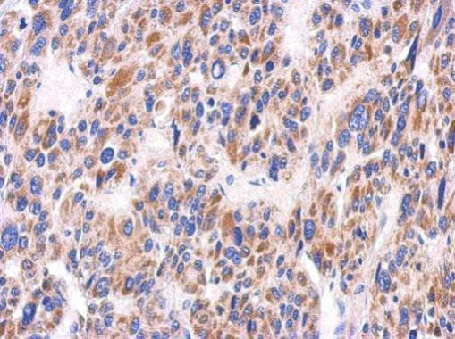 KIR2DS2 Antibody in Immunohistochemistry (Paraffin) (IHC (P))