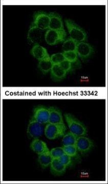 KIR2DS2 Antibody in Immunocytochemistry (ICC/IF)