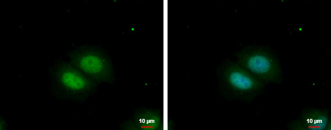 RBM22 Antibody in Immunocytochemistry (ICC/IF)