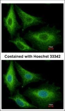 GSTK1 Antibody in Immunocytochemistry (ICC/IF)