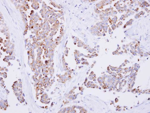 SARS2 Antibody in Immunohistochemistry (Paraffin) (IHC (P))