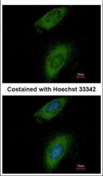 Annexin A8 Antibody in Immunocytochemistry (ICC/IF)