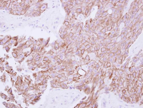 TMPRSS11B Antibody in Immunohistochemistry (Paraffin) (IHC (P))