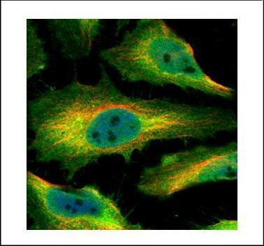 SMYD1 Antibody in Immunocytochemistry (ICC/IF)