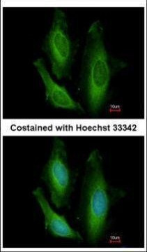 STBD1 Antibody in Immunocytochemistry (ICC/IF)