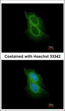Spinesin Antibody in Immunocytochemistry (ICC/IF)