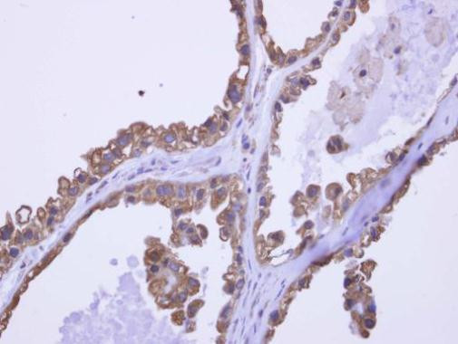 DDX43 Antibody in Immunohistochemistry (Paraffin) (IHC (P))