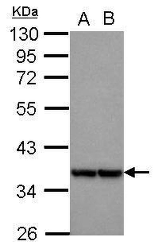 MRPL3 Antibody in Western Blot (WB)