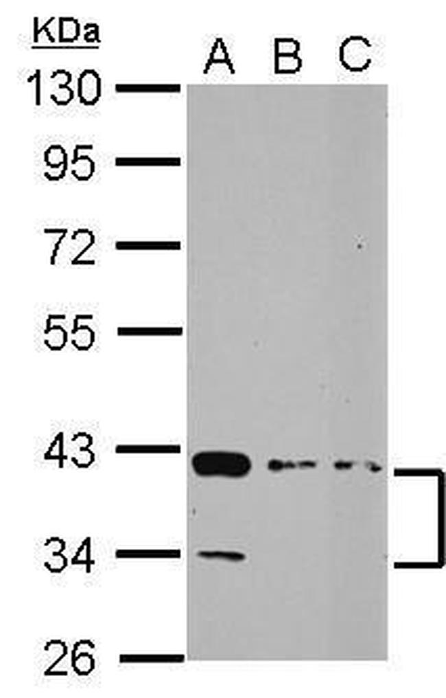 PDLIM3 Antibody in Western Blot (WB)