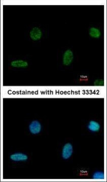 PGBD1 Antibody in Immunocytochemistry (ICC/IF)