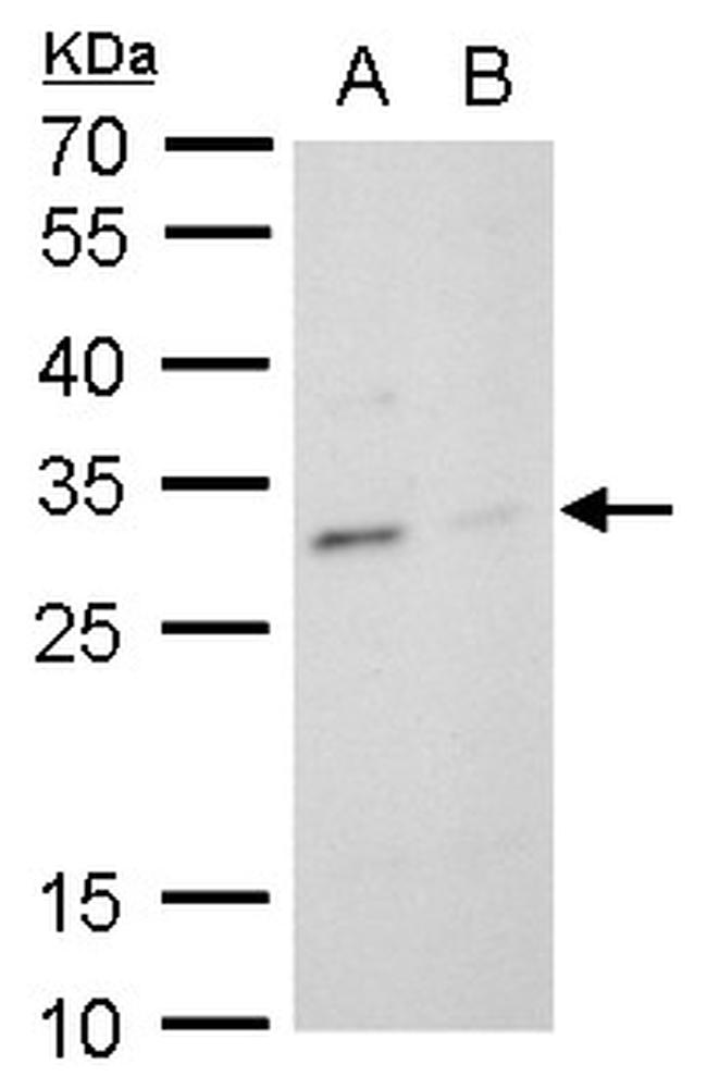TPPP Antibody in Western Blot (WB)