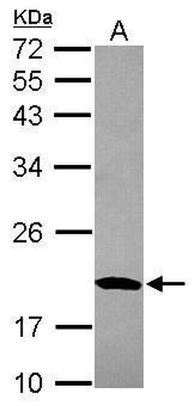 MRPS10 Antibody in Western Blot (WB)
