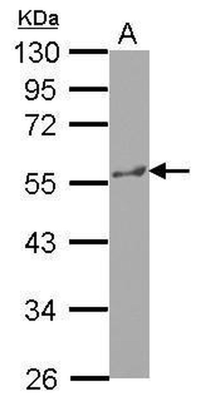 KATNA1 Antibody in Western Blot (WB)