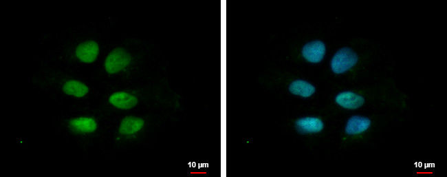 ZNF571 Antibody in Immunocytochemistry (ICC/IF)