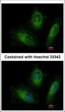 RAB20 Antibody in Immunocytochemistry (ICC/IF)