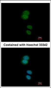 ZNF584 Antibody in Immunocytochemistry (ICC/IF)