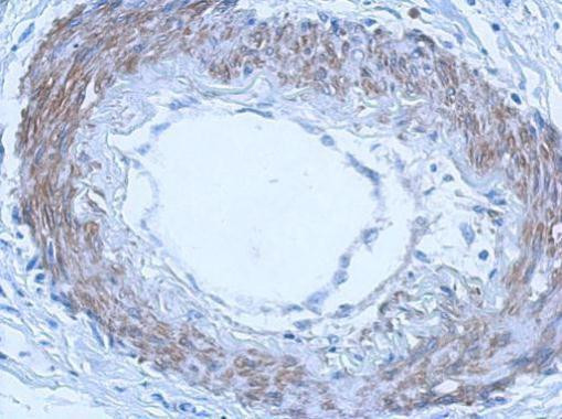 RGL4 Antibody in Immunohistochemistry (Paraffin) (IHC (P))