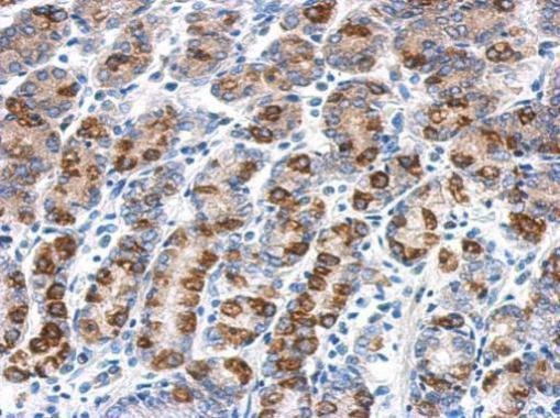CYB5R1 Antibody in Immunohistochemistry (Paraffin) (IHC (P))