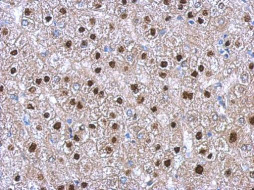 RNF92 Antibody in Immunohistochemistry (Paraffin) (IHC (P))