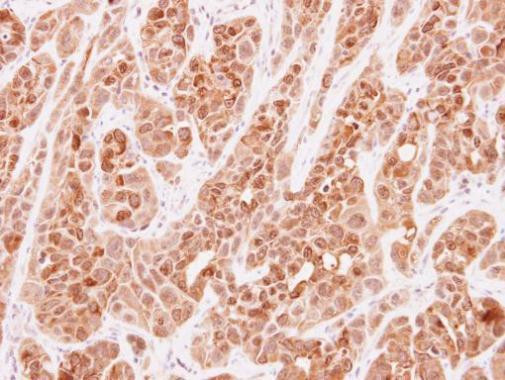 VLK Antibody in Immunohistochemistry (Paraffin) (IHC (P))