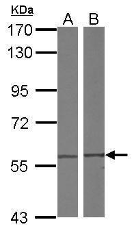 TCP-1 delta Antibody in Western Blot (WB)