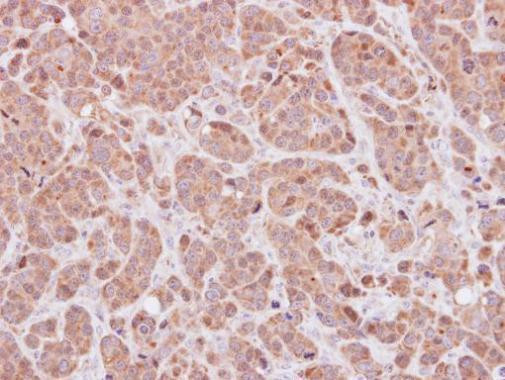 MOXD1 Antibody in Immunohistochemistry (Paraffin) (IHC (P))