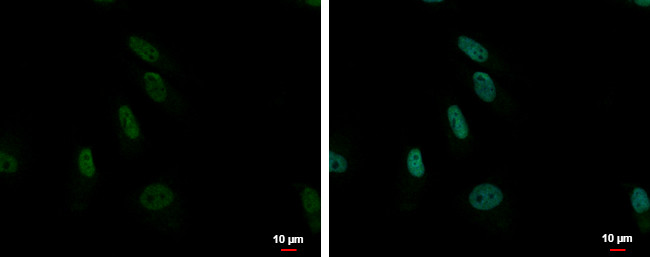 ZNF587 Antibody in Immunocytochemistry (ICC/IF)